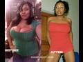 My 40lb Weight loss Before & After
