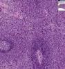 Shotgun Histology Spleen