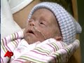 Grandmother Gives Birth to Granddaughters Grandmother Gives Birth to Granddaughters