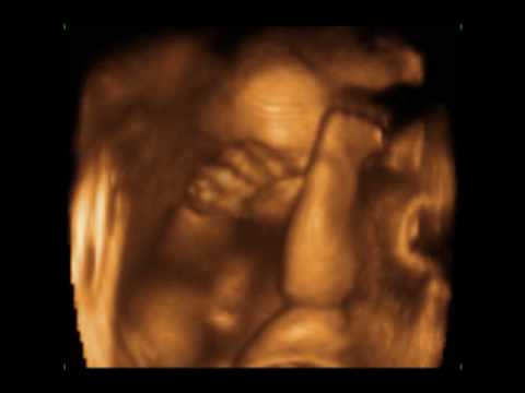 ultrasound 3d 4d - This is Jennica's baby 29 weeks ultrasound scan. Can you believe a baby in the womb may do things like we adults? This is a genuis baby for sure! Merry Chris...