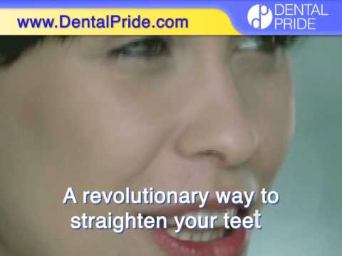 Invisalign Beyond Limits