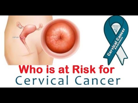 how to treat cervical cancer