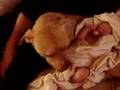 Pit bull attack 3 week old baby