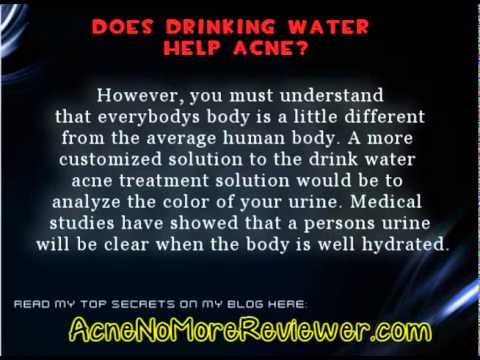 Does Drinking Water Help Acne – Would It Be A Fact? philipfbfish