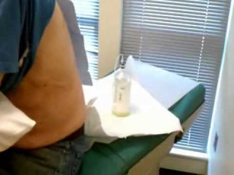 how to drain fluid from lungs