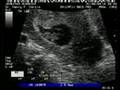 Zygote 8 Weeks