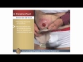 Welcome to the American College of Surgeons (ACS) After Surgery Care Ostomy Program. You and your family are important members of the surgical team. Watching these video chapters should help you understand how to care for yourself or family member after your operation. The easy-to-follow instructions cover your operation (urostomy, colostomy and ileostomy), ostomy pouches, problem solving, and how to empty, change and apply a new pouch. When you are done watching the programs, you may find more information regarding the ACS After Surgery Care Ostomy Program at www.facs.org . Other resources are also provided, including how to order a skill kit and the skill booklet. The standardized interactive program has been developed by the American College of Surgeons (ACS) with input from the American Society of Colon and Rectal Surgeons (ASCRS), American Urological Association (AUA), Certified Enterostomal Therapy Nurses (CETN), and the United Ostomy Associations of America (UOAA).