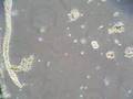 videos de dancing worms