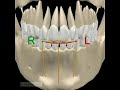 mandibular movement - horizontal view