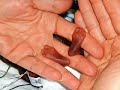 Dr. Julio Castro G�mez: Concebido es producto fetal