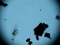 rotifer Adineta steineri found in forest litter, Poland