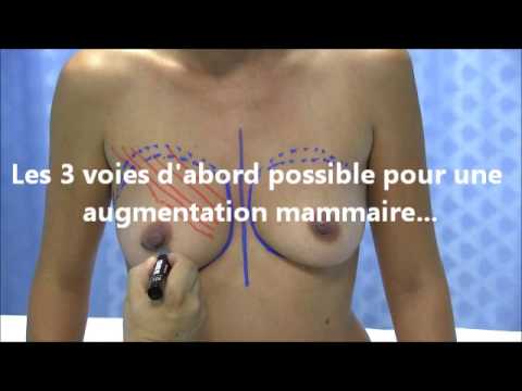 Les forums sur une petite poitrine