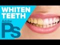 Photoshop: White Teeth (HD)