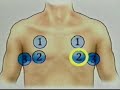 assessment respiratory expansion