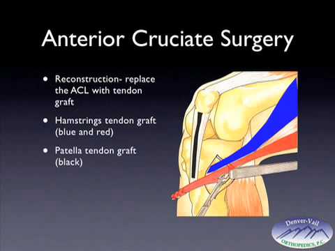 how to cure muscle strain