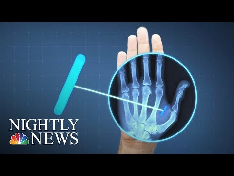 Human Microchip Implants and the Internet of Bodies – mercola.com