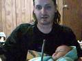 DJ  and Craniosynostosis crane-eo-SINOS-tow-sis