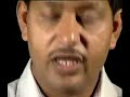 Module 2 Lecture 2 Finite Element Method