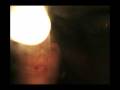 videos de Monday Massacre
