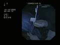 endoscopy