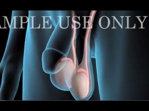 Medical conditions of penis