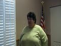 Happy Patient 1 Week After the Mini-Gastric Bypass