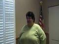 Happy Patient 1 Week After the Mini-Gastric Bypass