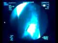 videos de X-Ray Drinking 12-03-08
