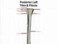 Posterior Bone Landmarks (Tibia and Fibula)
