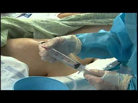 how to treat pressure sores