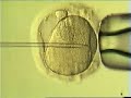 Fecundación In Vitro