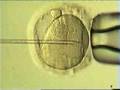 Fecundación In Vitro