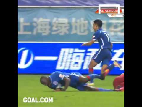 Pemain bolasepak terkenal patah kaki Pemain bolasepak terkenal patah kaki