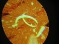 videos de Psychedelic Avalonian Remix