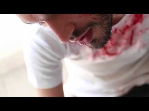 Immagine anteprima YouTube