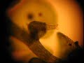 Bdelloid rotifer lives in liverwort lobule