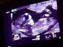 omigie love godwin love.s babyloves video