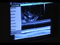 Baby Scan 1