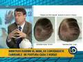 Plagiocefalia