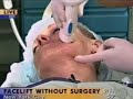 Dr. Copeland demonstrates Thermage. Dr. Copeland demonstrates Thermage.