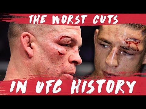 The Worst Cuts in UFC History