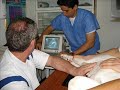 TORACOCENTESIS ECOGUIADA TORACOCENTESIS ECOGUIADA
