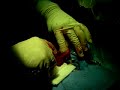 Canine Bladder Stone Removal Procedure