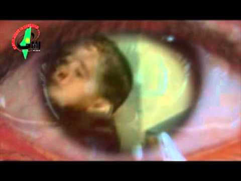 See video