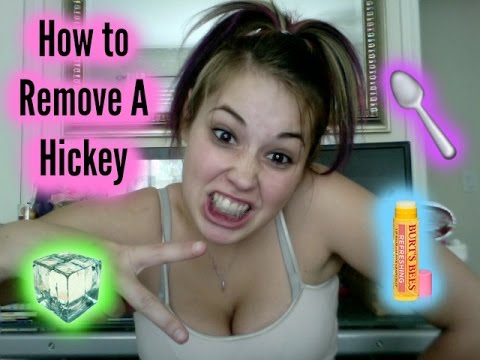 how to remove hickies