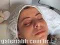 Mat�ria Peeling