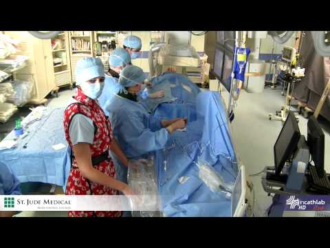 how to measure ffr