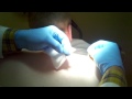Cyst - Part 1