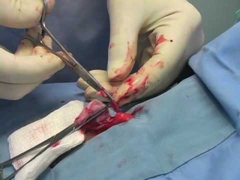 castration