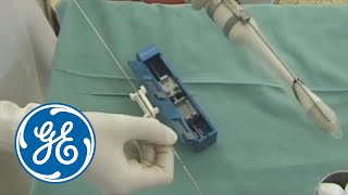 Tru-Cut Biopsy in Gynecologic Oncology